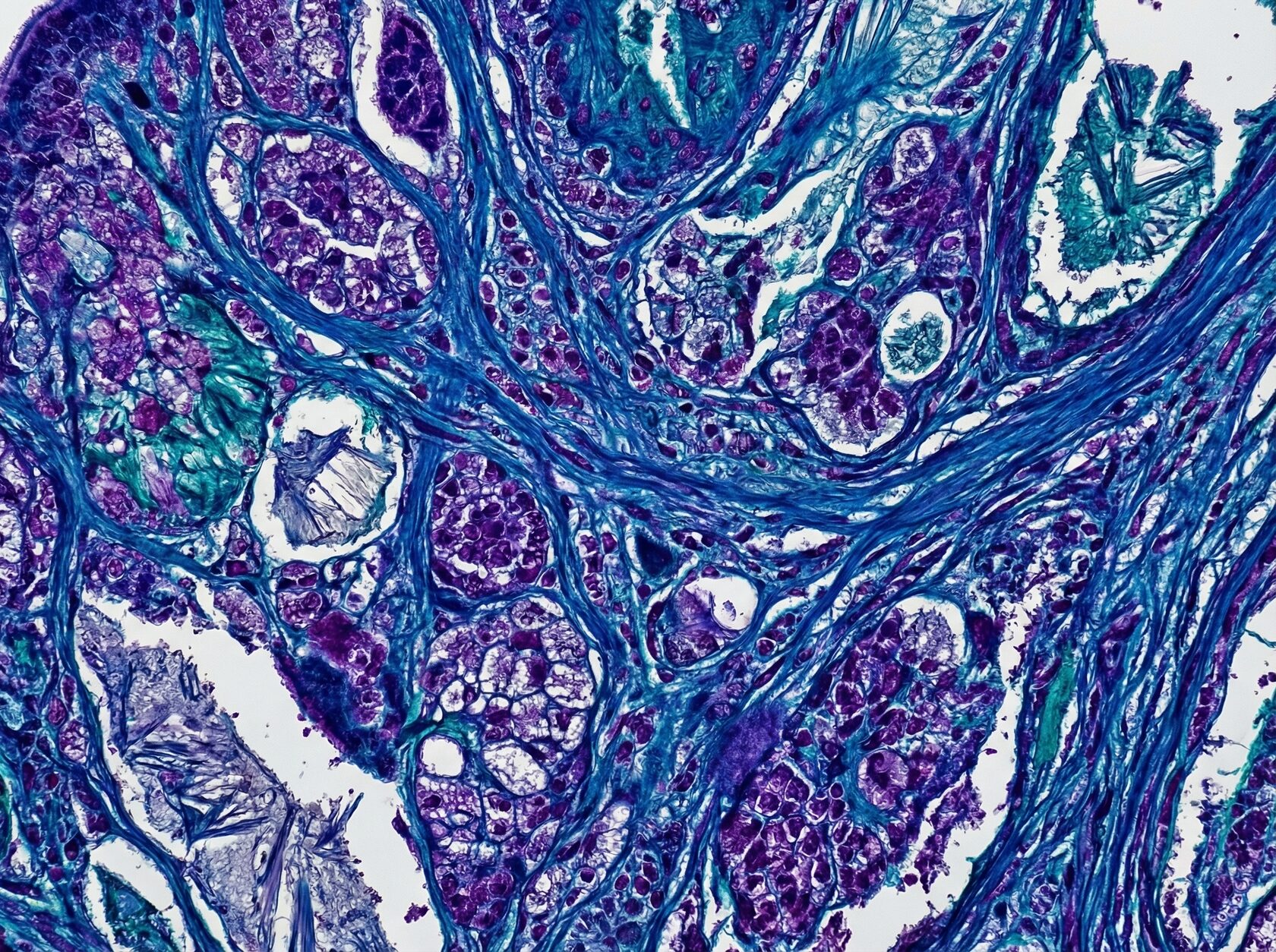 Иллюстрация компонента Hexapeptide-11