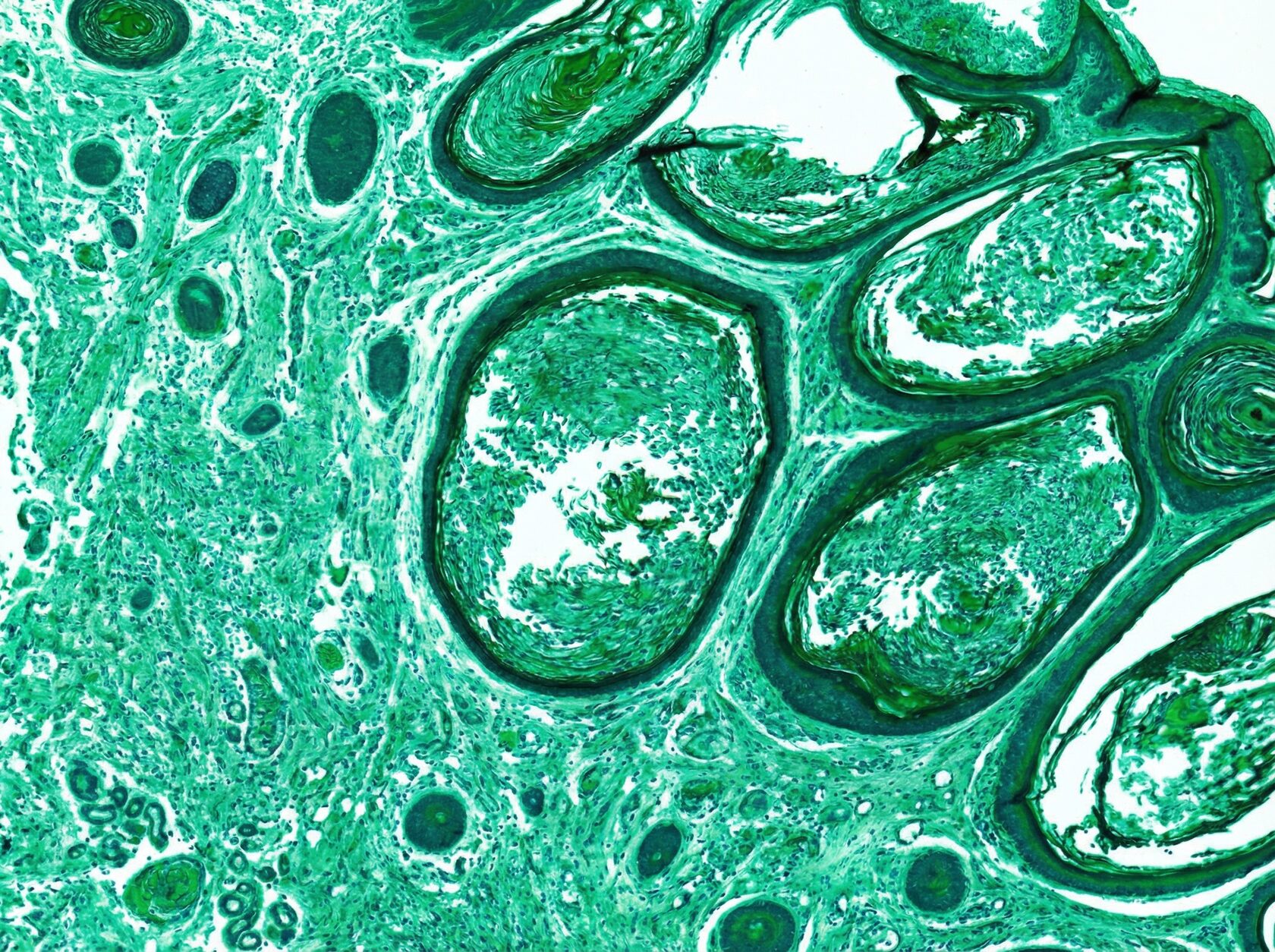 Иллюстрация компонента Palmitoyl Tripeptide-5